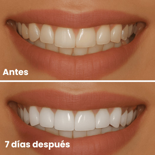 FlashWhite Strips OFERTA LIMITADA 52% OFF +REGALO