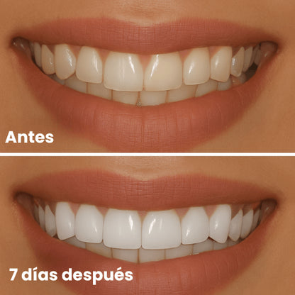 FlashWhite Strips OFERTA LIMITADA 52% OFF +REGALO